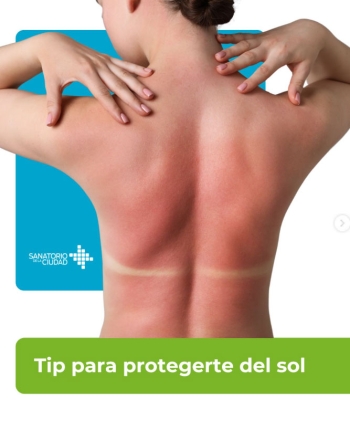 Tips para protegerte del sol